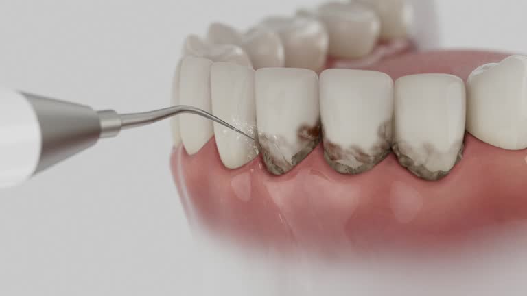 Reliable Dental Implants contractor in Parker County County, TX by Dentist Open Now